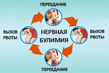 Лечение булимии в Тайге
